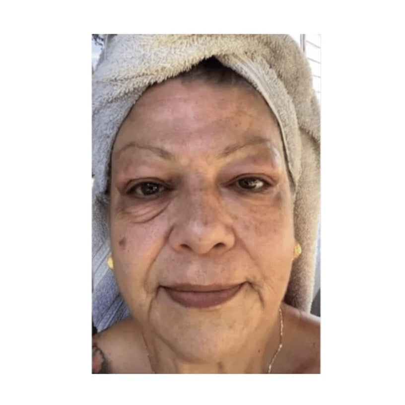 Anti-Aging Eye Cream – Bioaqua™