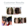 GlowScalp™ Head Massager Brush