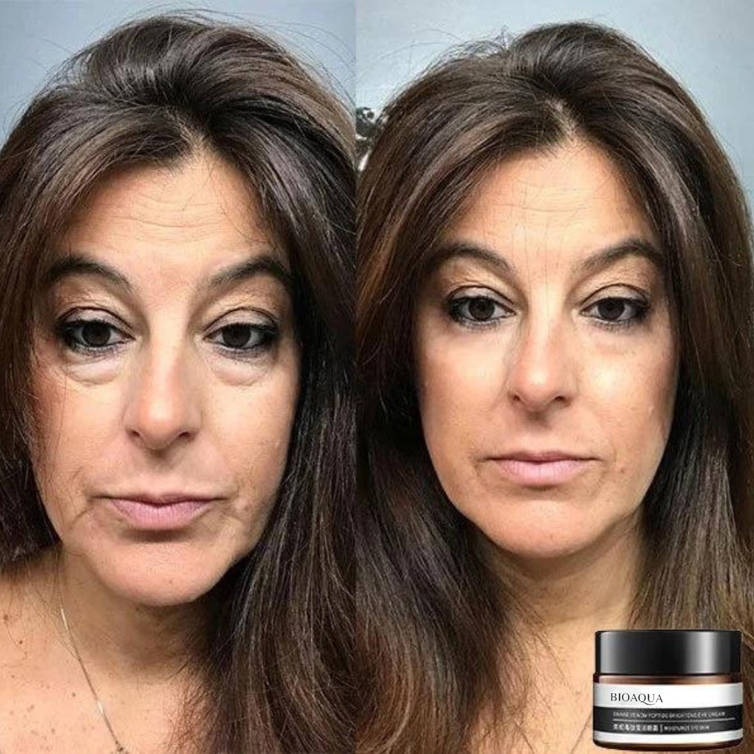 Anti-Aging Eye Cream – Bioaqua™