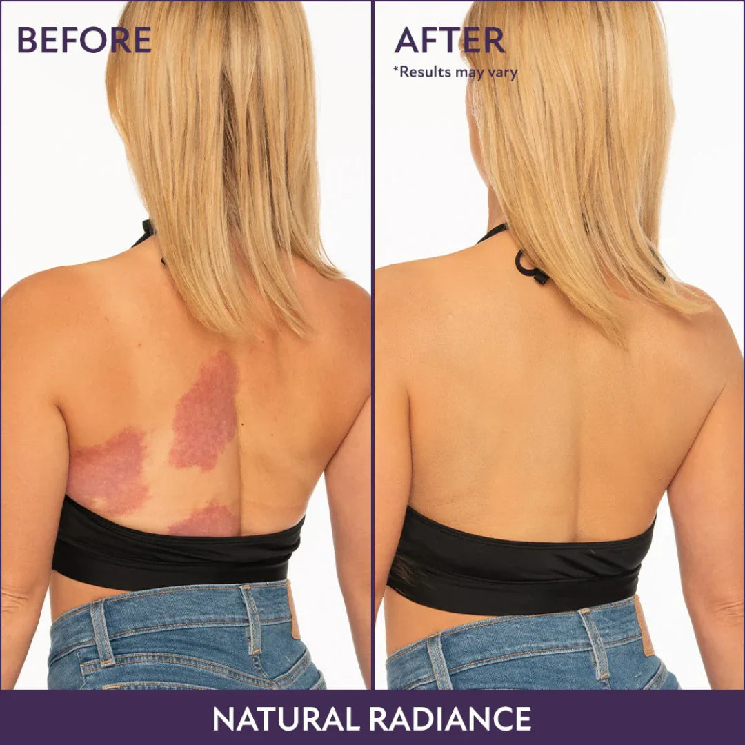Glyssa | Body Coverage Foundation