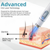 Bikenda™ | Non-Invasive Mole and Wart Removal Laser Pen Promax