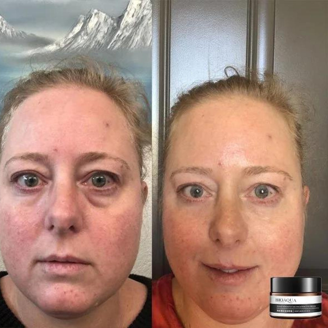 Anti-Aging Eye Cream – Bioaqua™