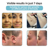 Bikenda™ | Non-Invasive Mole and Wart Removal Laser Pen Promax