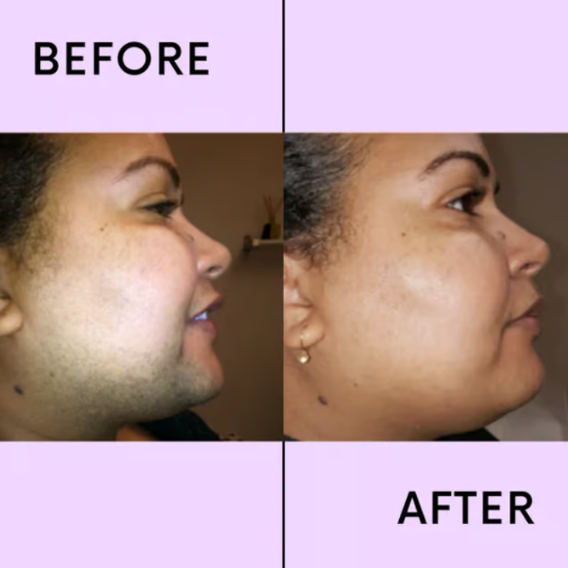 SmoothEase - Effortless Hair Removal Cream