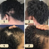 Eelhoe™ | Your Natural Hair Growth Oil