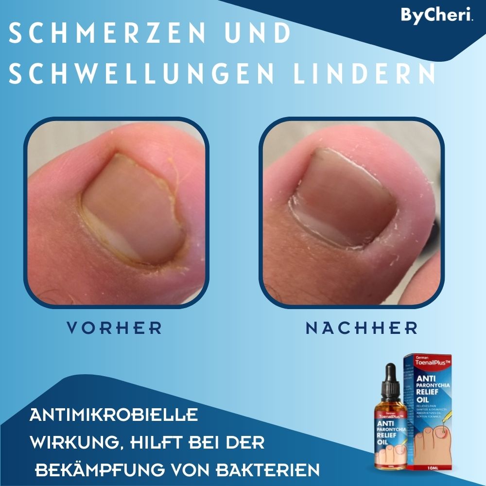 ToePerfect™ | Heals Toenails and Fingernails
