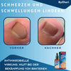 ToePerfect™ | Heals Toenails and Fingernails