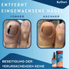 ToePerfect™ | Heals Toenails and Fingernails