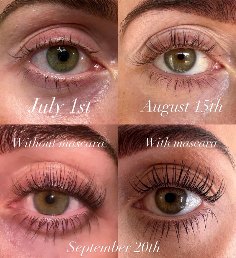 Kaylash™ Growth Serum