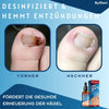 ToePerfect™ | Heals Toenails and Fingernails