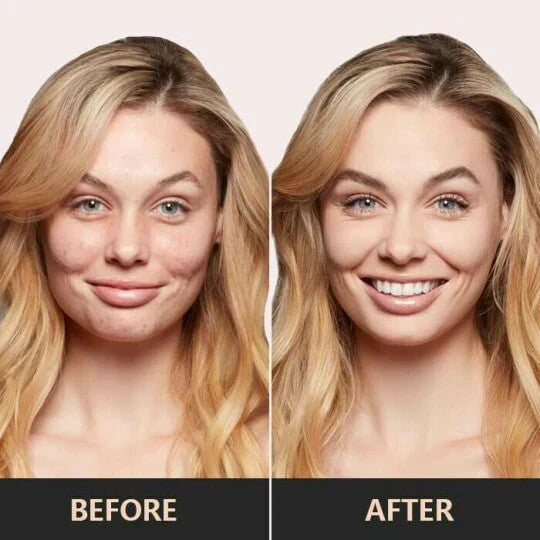 MushroomRadiance™ | Unveil Flawless Skin That Turns Back Time