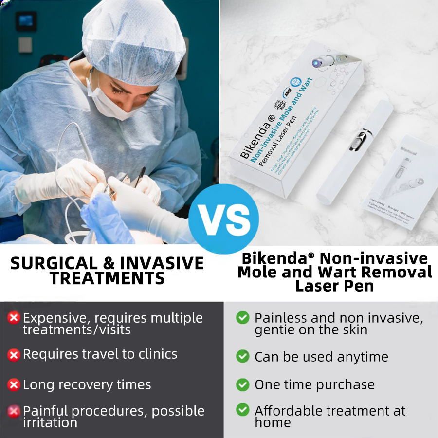 Bikenda™ | Non-Invasive Mole and Wart Removal Laser Pen Promax