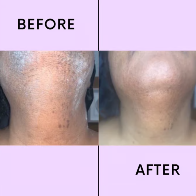 SmoothEase - Effortless Hair Removal Cream