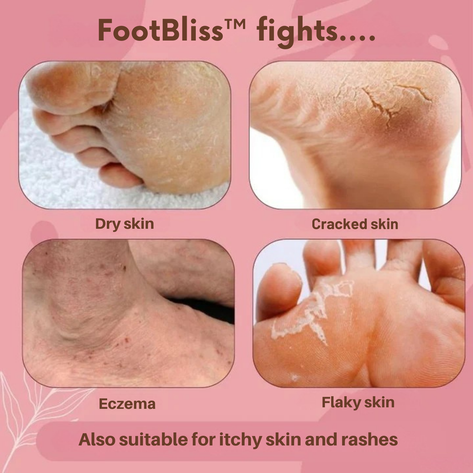 FootBliss™ Soothing Foot Renewal