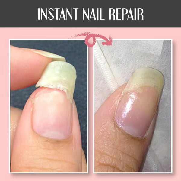 NailVive™ | Revive Damaged Nails Naturally