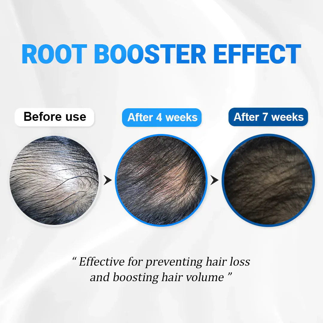 Hair Growth Serum 29,95$ TODAY ONLY