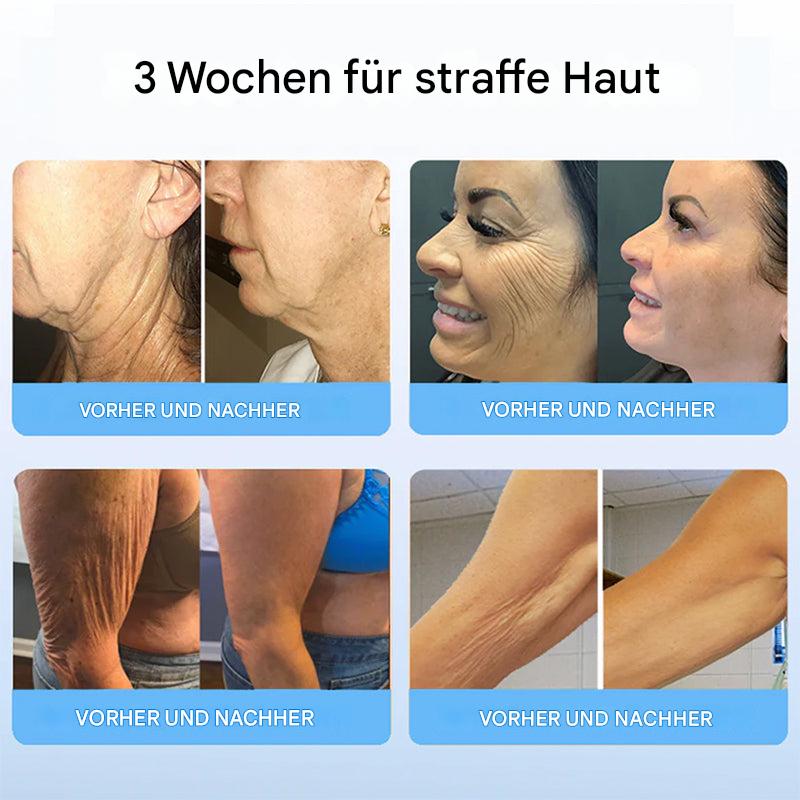 Liftora™ – Tighten and Firm Your Skin Without Surgery