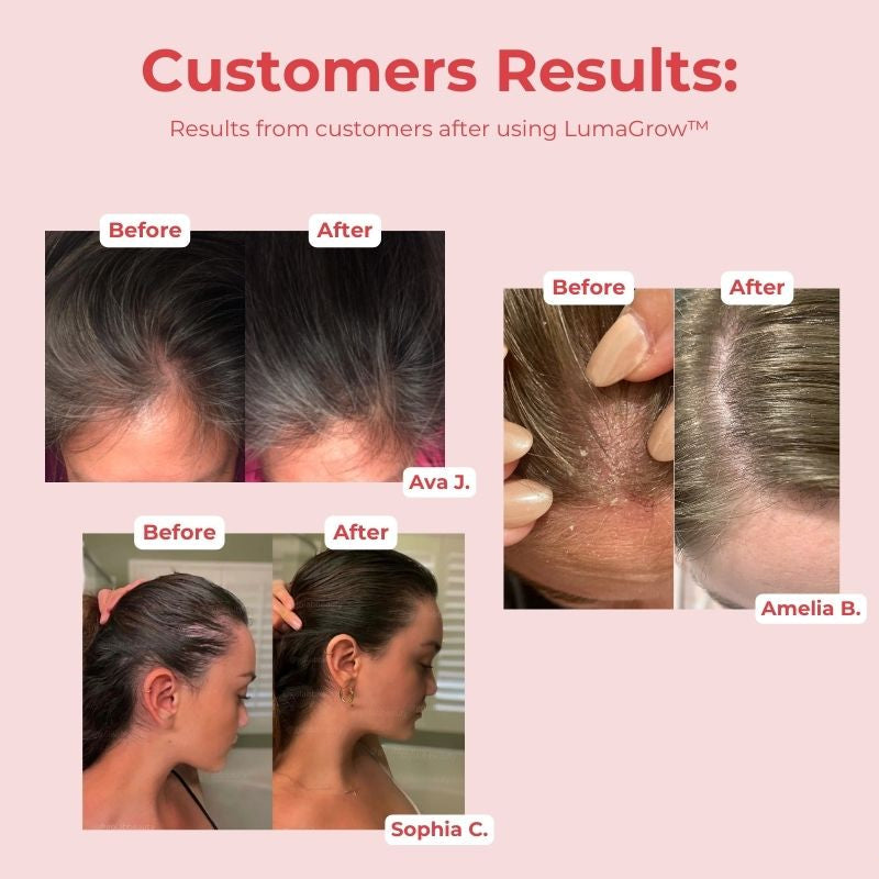 LumaGrow™ Scalp Massager