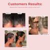 LumaGrow™ Scalp Massager