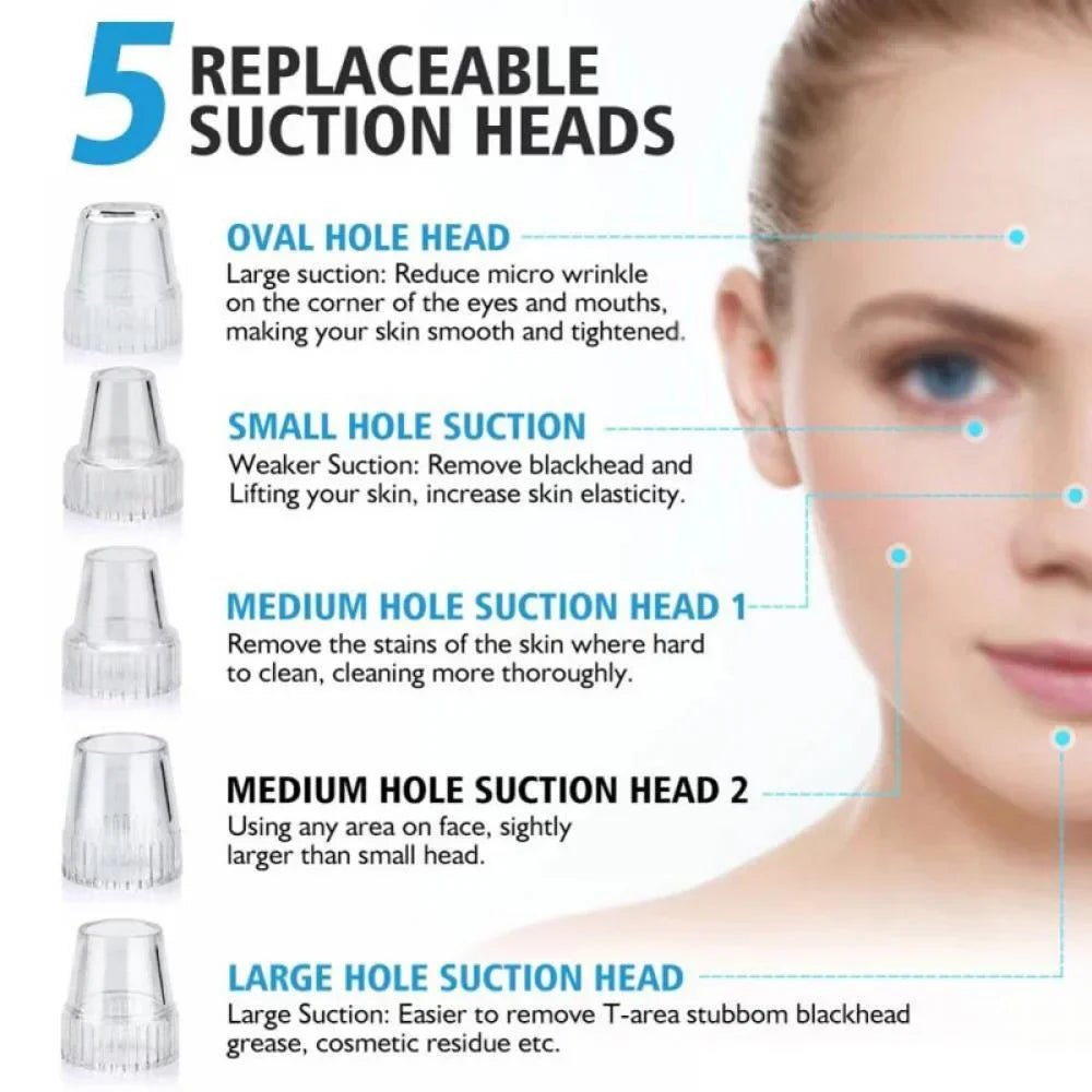 Electric Blackhead Remover
