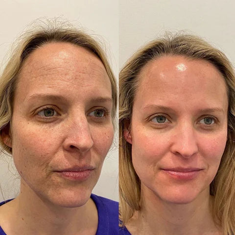PureLure™ Deep Cleanser — Lets you achieve professional-level skin care from the comfort of your home