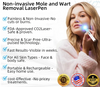 Bikenda™ | Non-Invasive Mole and Wart Removal Laser Pen Promax