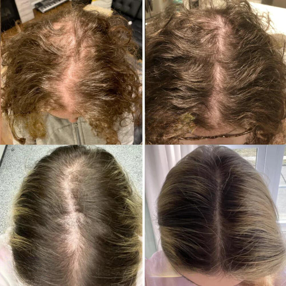 Eelhoe™ | Your Natural Hair Growth Oil