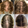 Eelhoe™ | Your Natural Hair Growth Oil