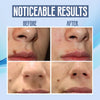 SpotClear™ | Dark Spot Vanisher in just Few Weeks