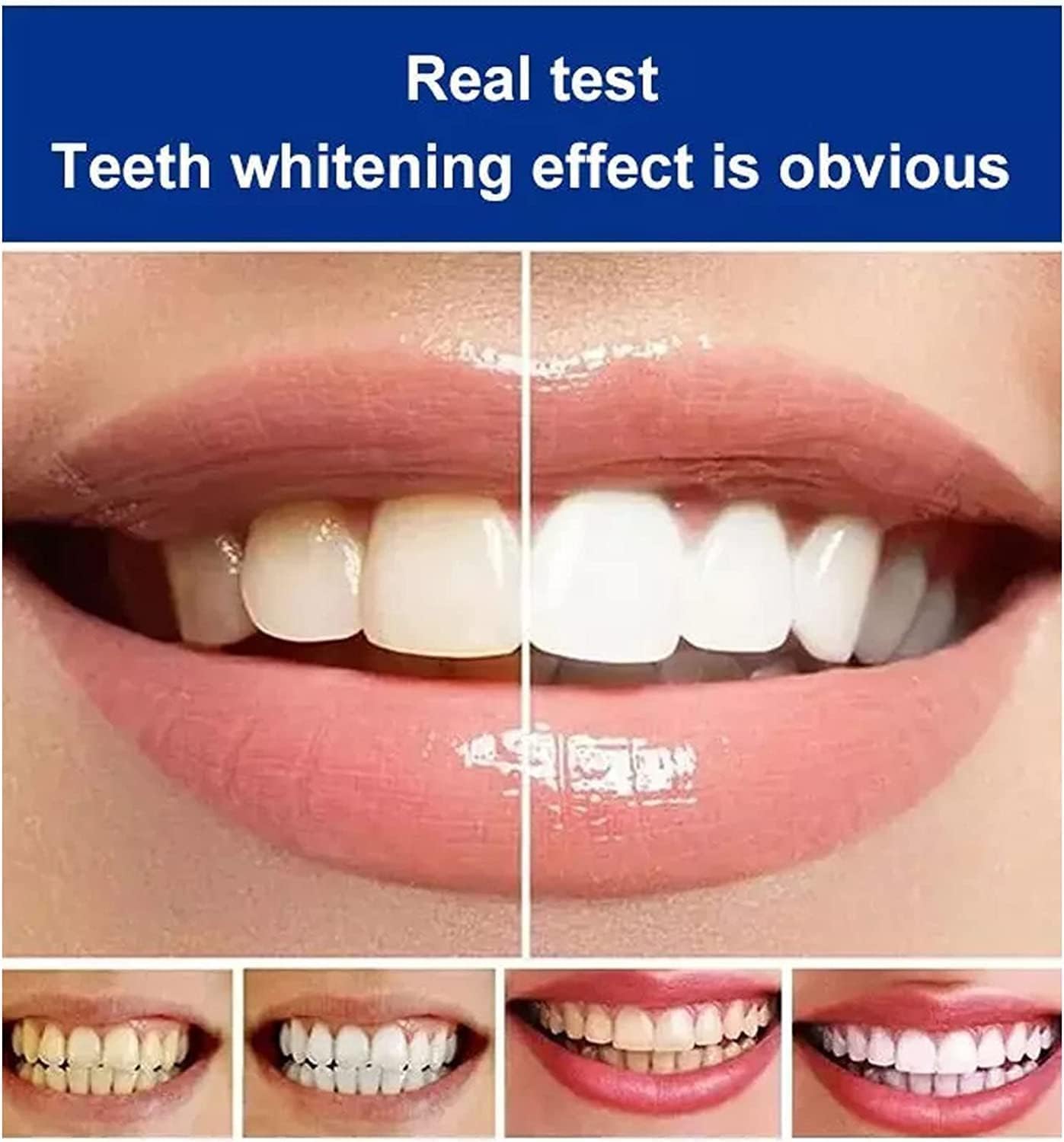 Brighto™ - Natural Teeth Whitening