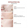 Piel™ – ClearSkin Exfoliating Gel (30-day Guarantee)