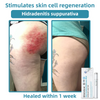Bikenda™ | Non-Invasive Mole and Wart Removal Laser Pen Promax