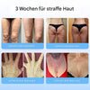 Liftora™ – Tighten and Firm Your Skin Without Surgery