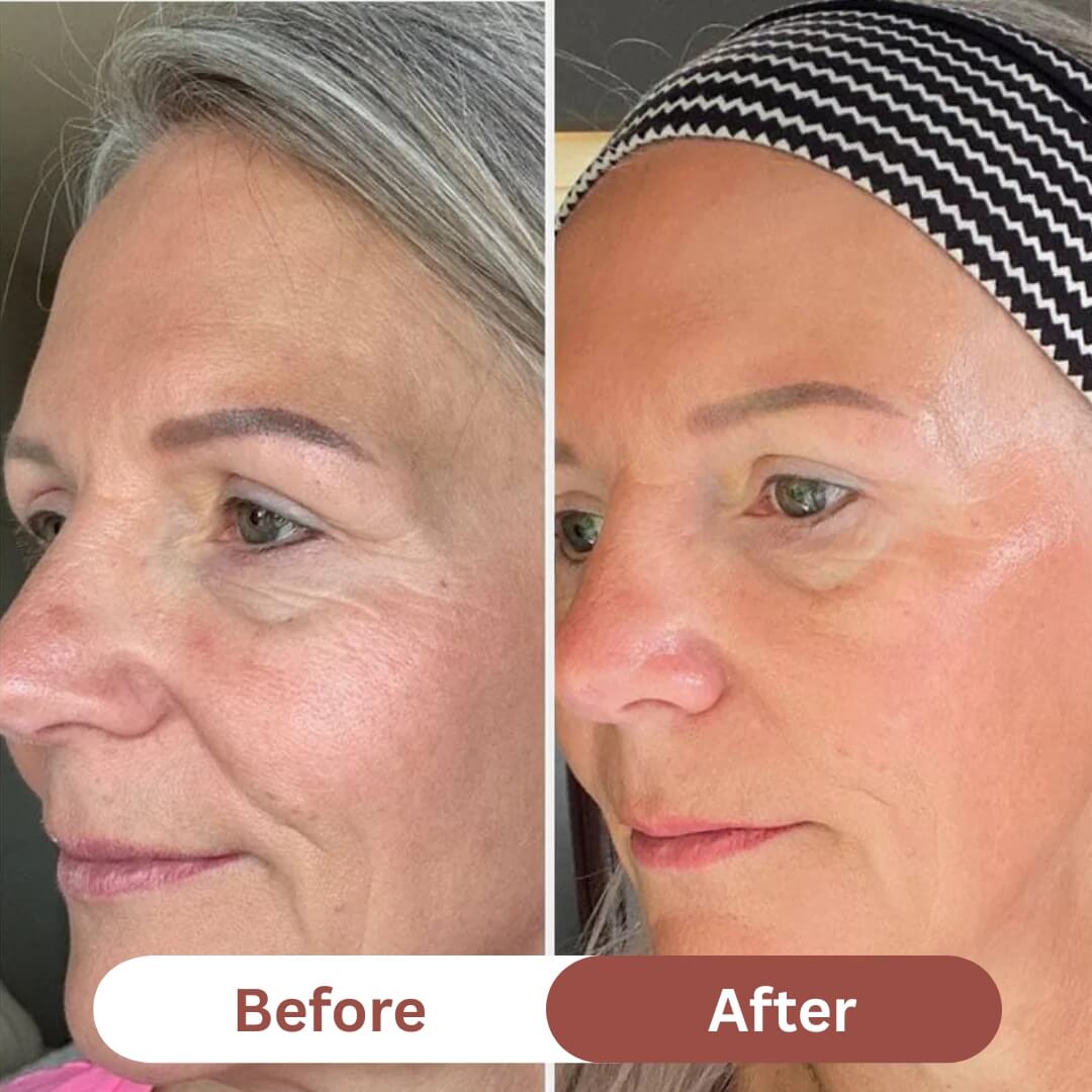 Bio-Collagen Mask