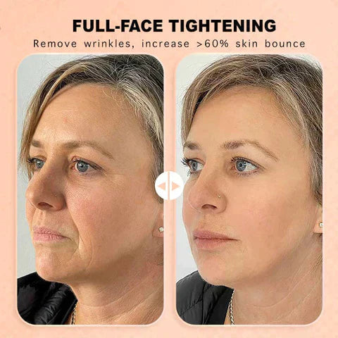 YouthRevive™ | Age-Defying Wrinkle Cream Balm
