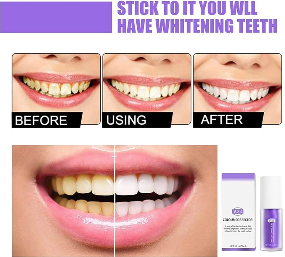 SmileKit™ | Feel more confident with a fresh, radiant smile that lasts