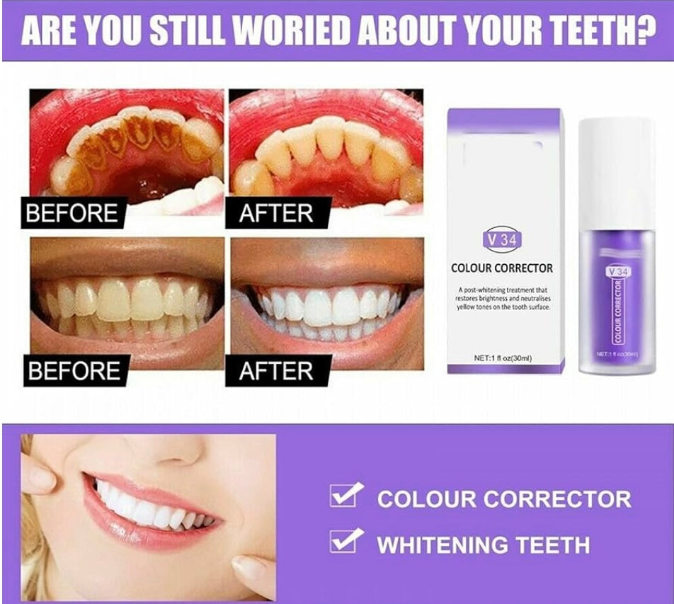SmileKit™ | Feel more confident with a fresh, radiant smile that lasts