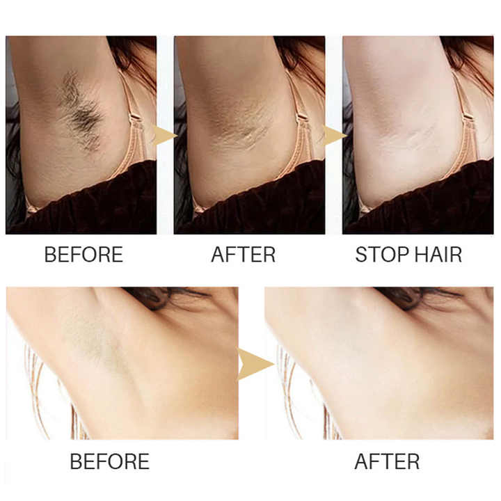Hair Removal Serum™ – Smooth Skin, Effortlessly