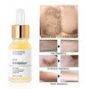 Hair Removal Serum™ – Smooth Skin, Effortlessly