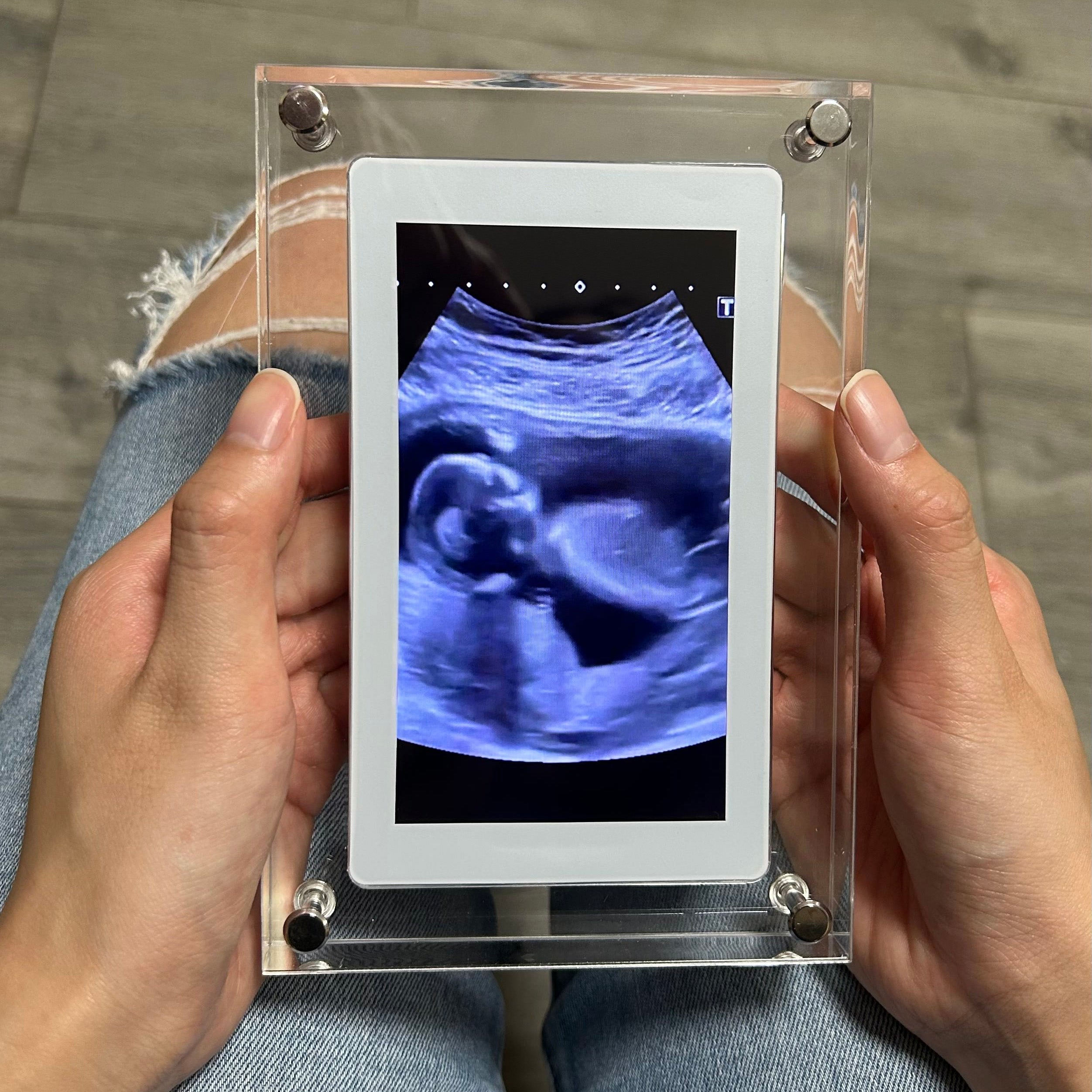 FrameIt™ – Digital Photo Frame for Elegant Memory Display