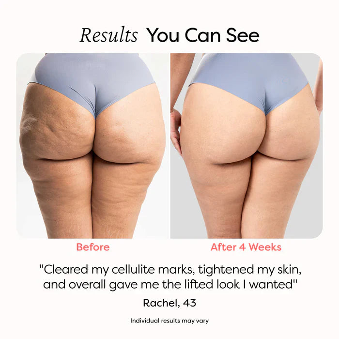 Smooth Cellulite Roller