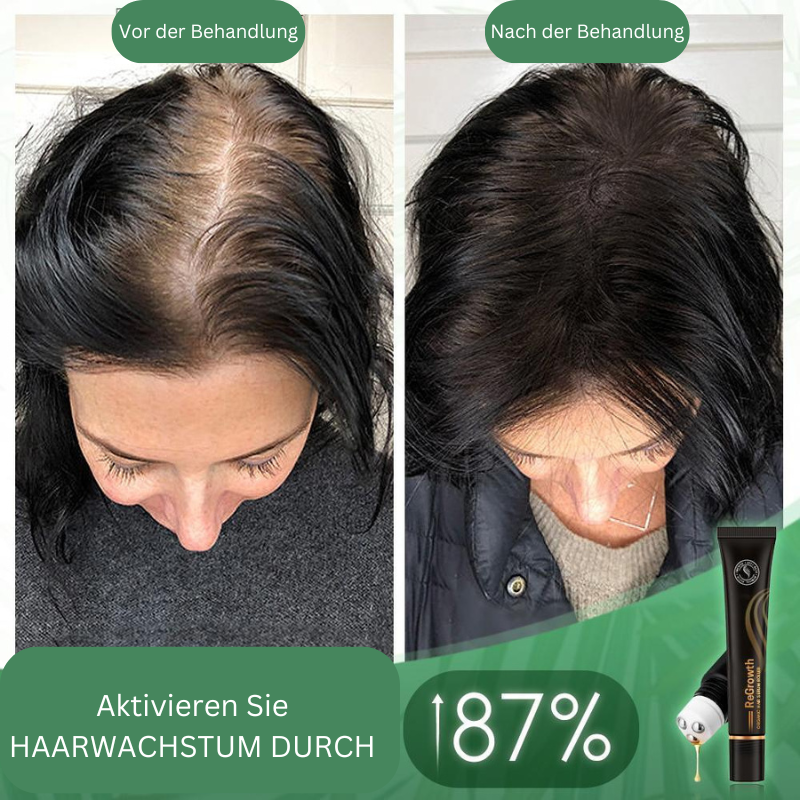 HairBoost™ Bio Hair Serum Roller