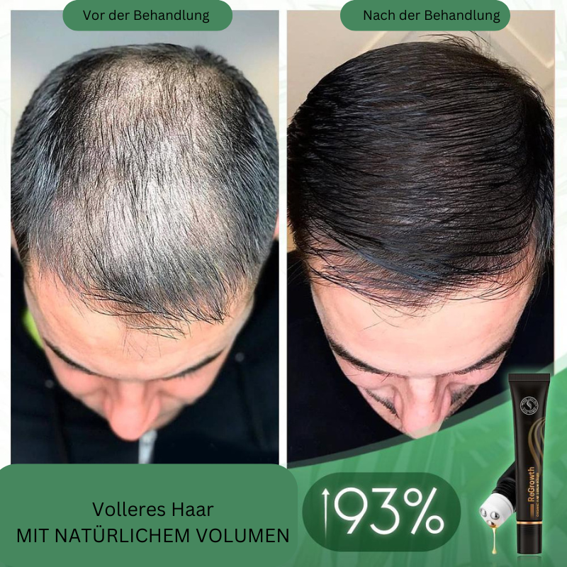 HairBoost™ Bio Hair Serum Roller