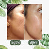 Green Tea Mask
