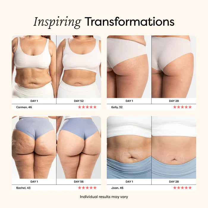 Smooth Cellulite Roller