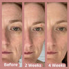 Bio-Collagen Mask