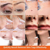 Painless Auto Skin Tag Remover Kit