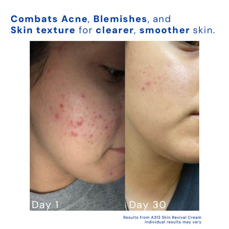 Retinol Face Cream