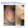 Retinol Face Cream
