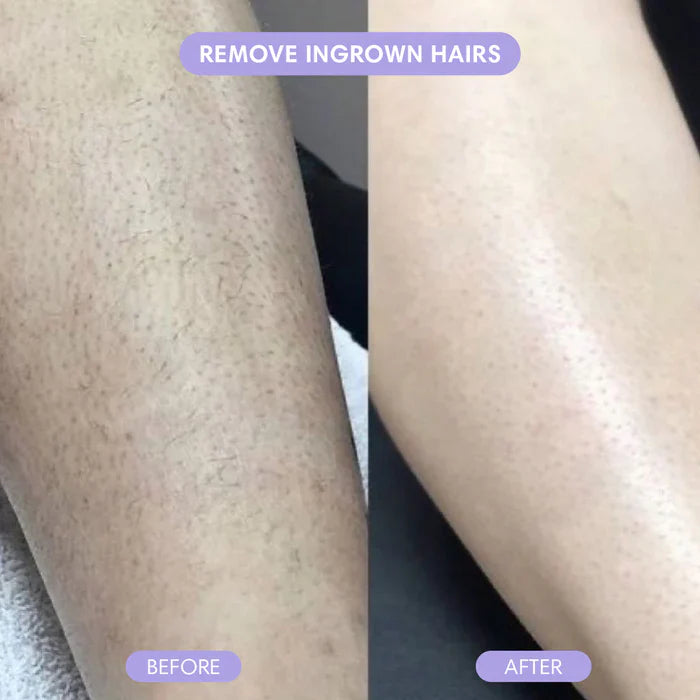 Silktrim™ | Dual Precision Shaver